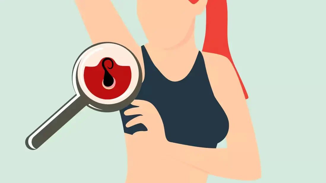 What Causes Ingrown Hairs and How to Avoid Them - Beauty Logix